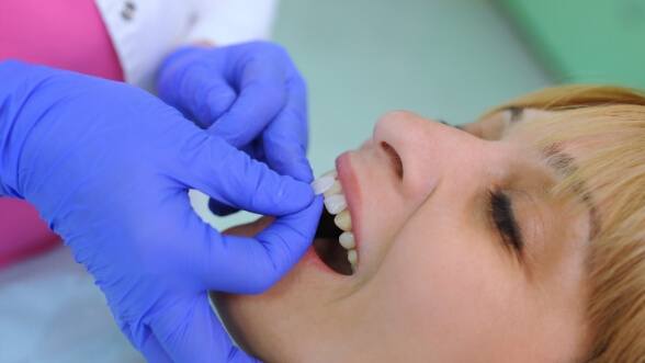 Dentist holding veneer in front of a patients tooth