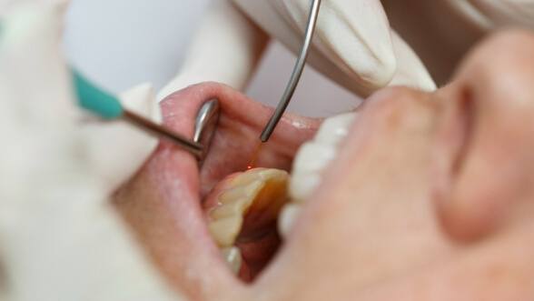 Dental patient being treated with soft tissue laser