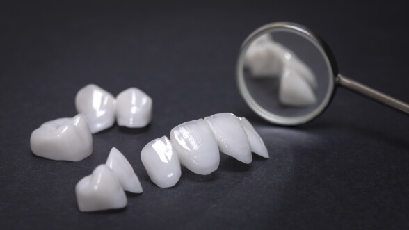 Several white dental crowns and veneers next to dental mirror