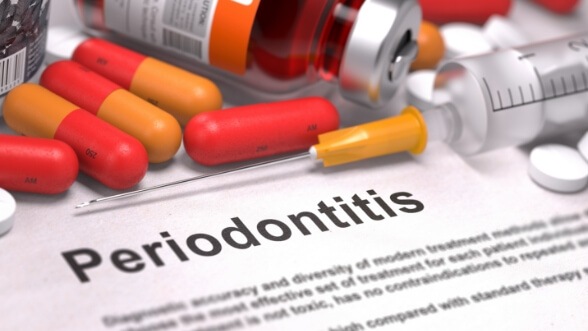Several medications next to a paper that says periodontitis