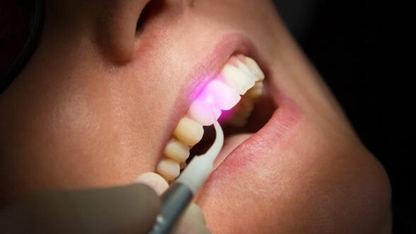Close up of a patient receiving laser gum disease treatment