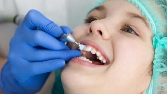 Dental patient having fluoride applied to their teeth